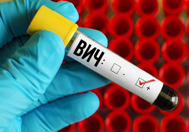 В Рогачевском районе возбуждено 8 уголовных дел за умышленное заражение ВИЧ
