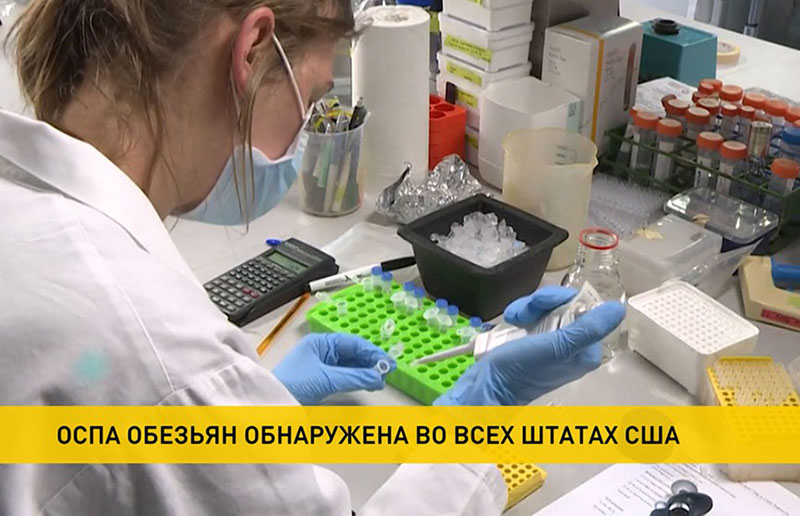 Оспа обезьян распространилась на все штаты США